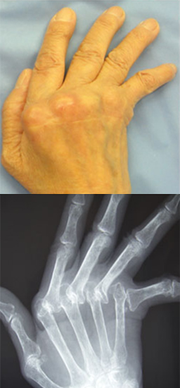 慶元整形外科リハビリ骨粗鬆症クリニックのリウマチ科